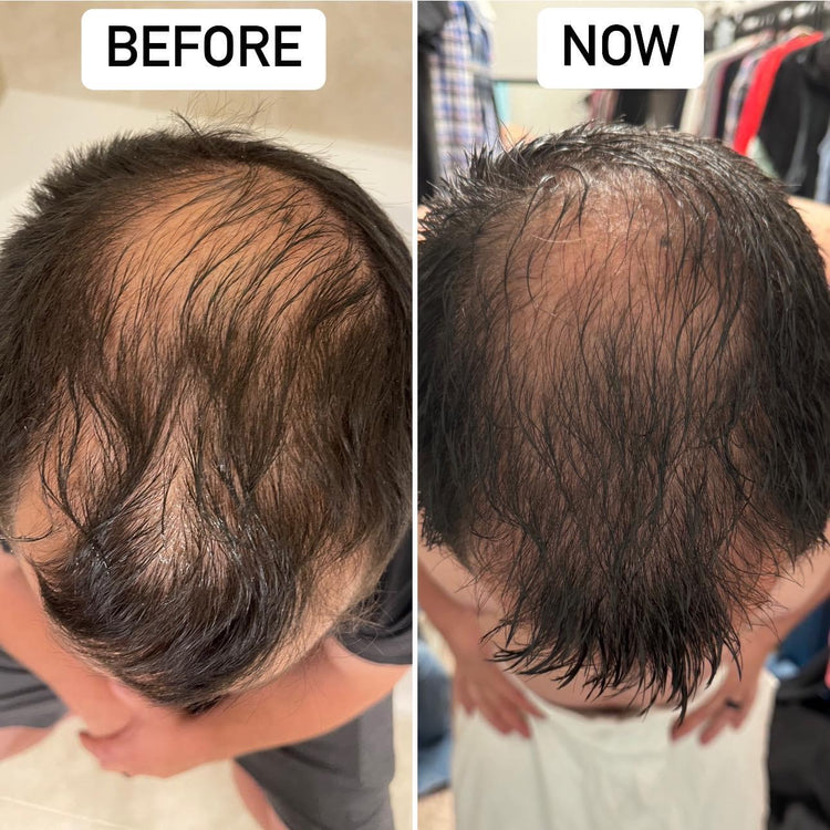 Hair Regeneration Spray